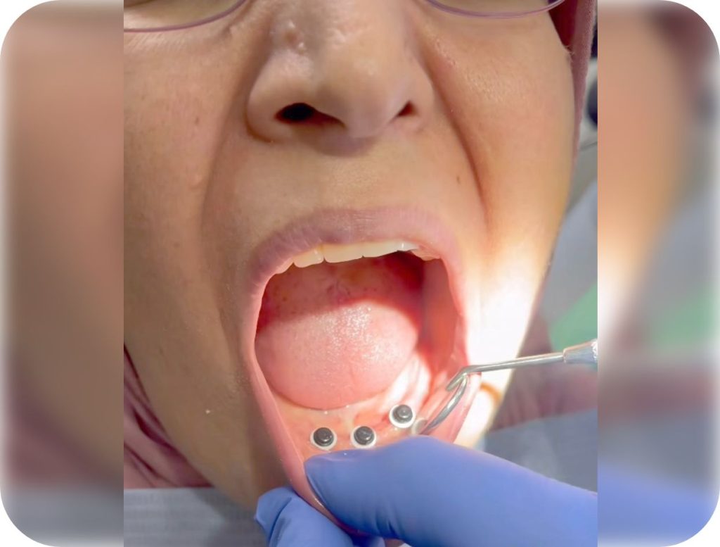 Groupe de masques 36@2x