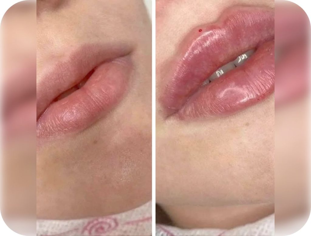 Groupe de masques 37@2x