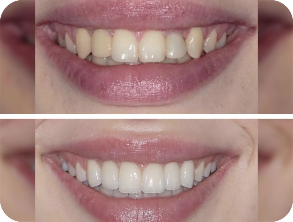 Groupe de masques 40@2x