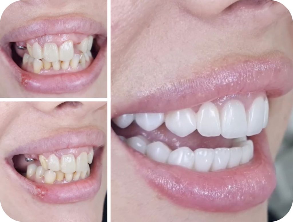 Groupe de masques 41@2x