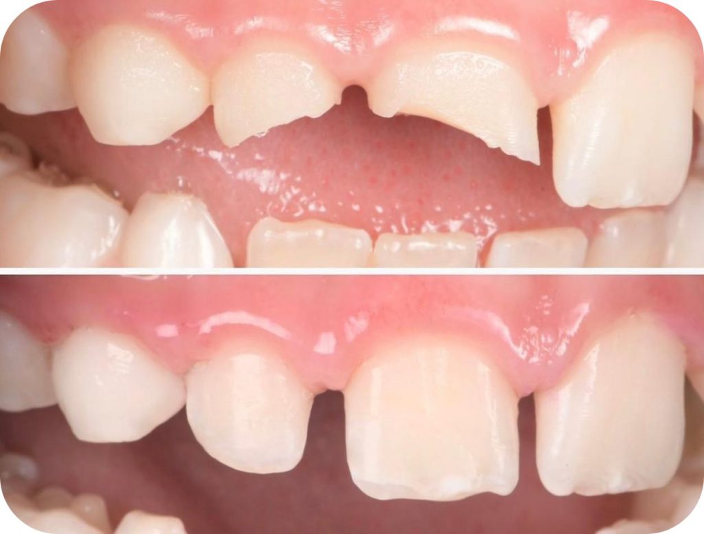 Groupe de masques 42@2x