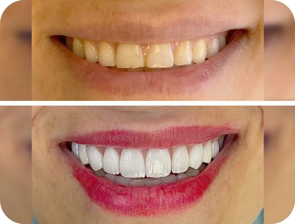 Groupe de masques 43@2x