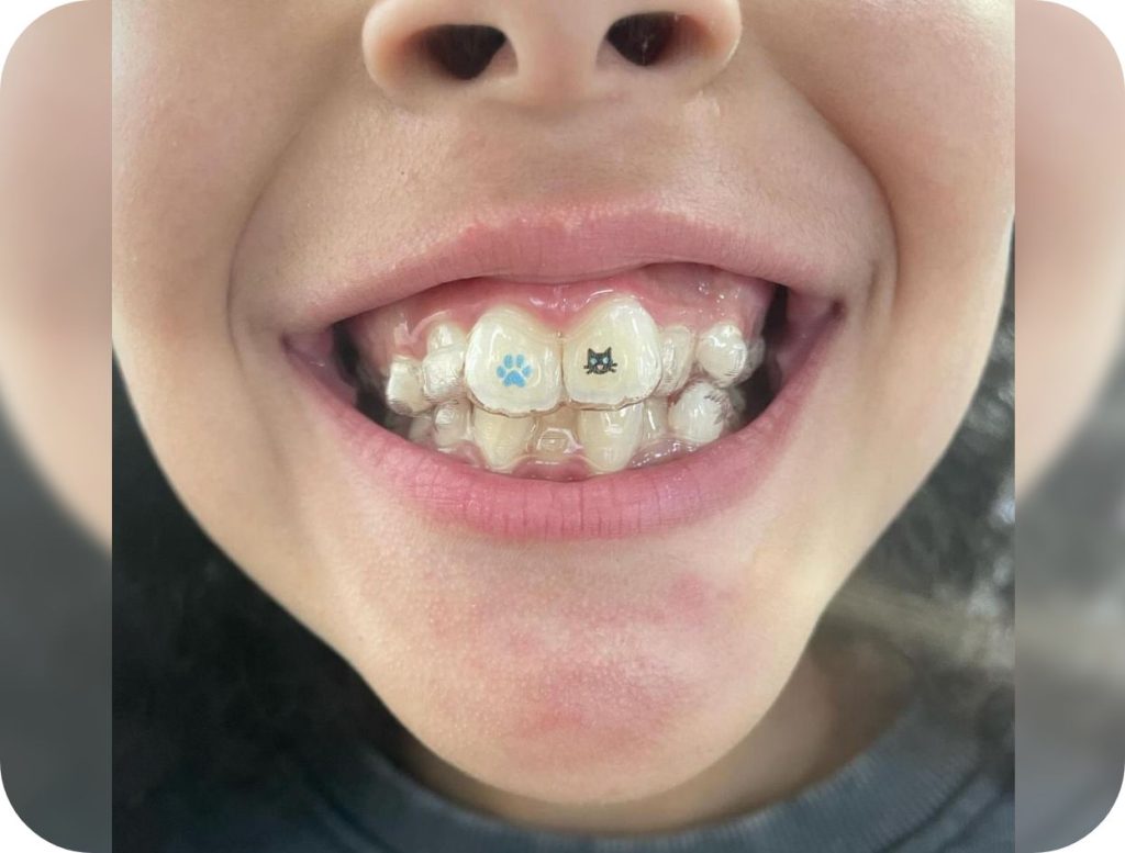 Groupe de masques 44@2x