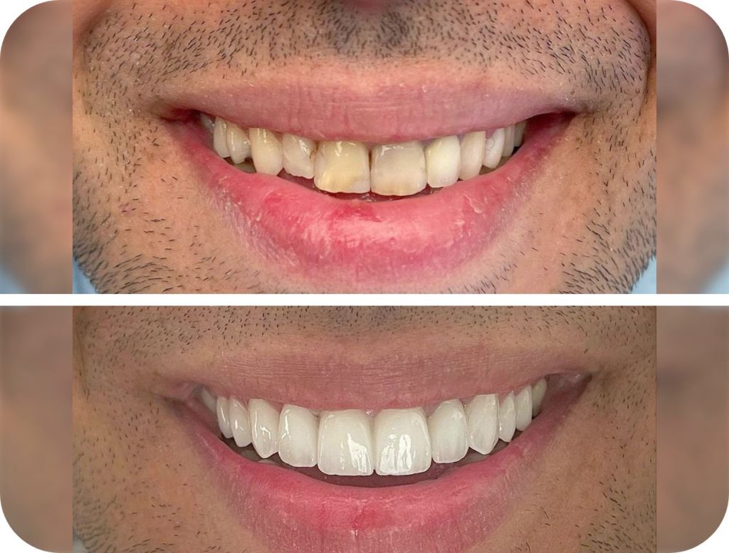 Groupe de masques 45@2x