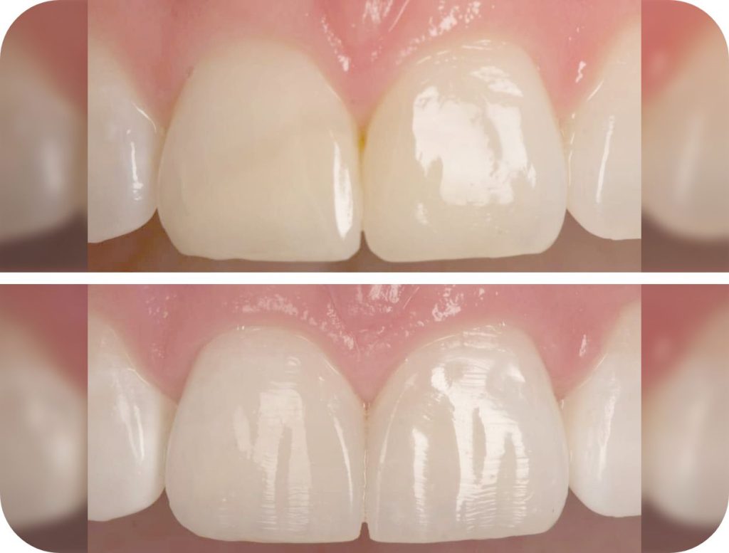 Groupe de masques 46@2x