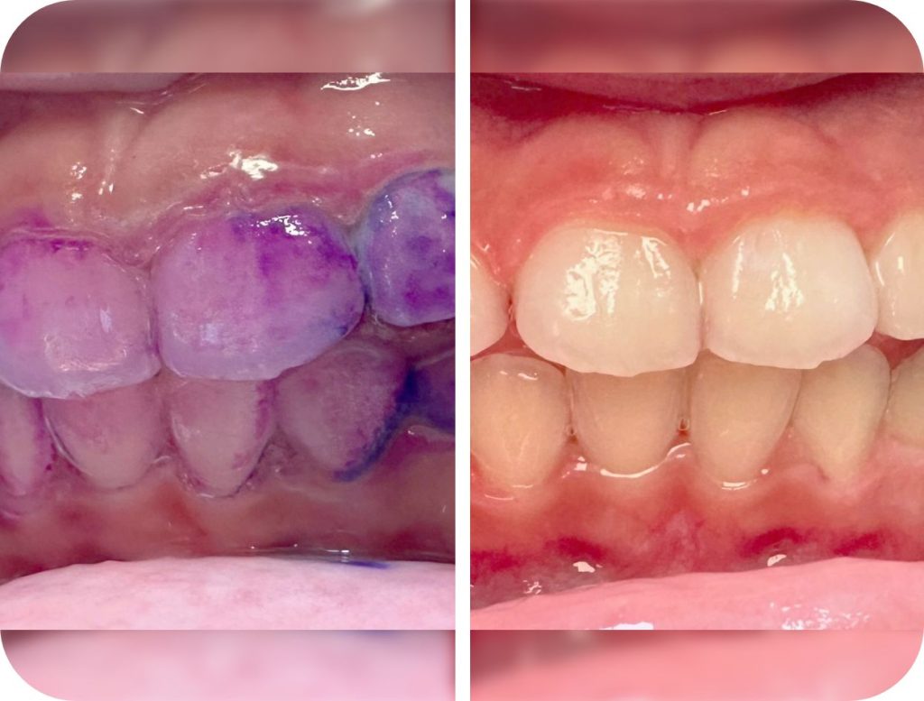 Groupe de masques 47@2x