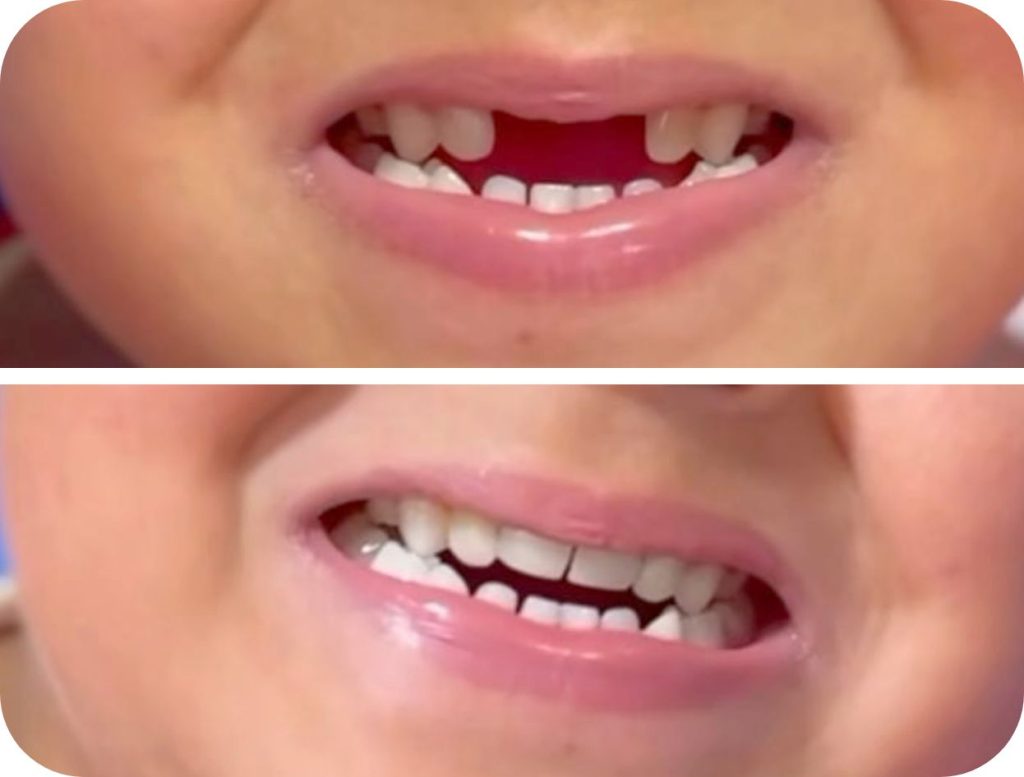 Groupe de masques 50@2x